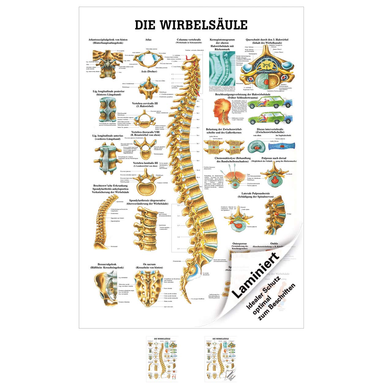 Ruediger Anatomie PO44 Meridiane & Dorntherapie Tafel 50x70 Cm – Hochglänzend, Anatomisch Genau