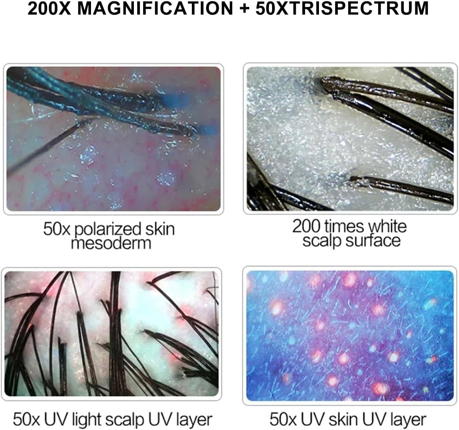 Scalp Hair Follicle Detector, Skin Diagnosis Hair Analyzer,15 Inch 50X 200X Lens Charging Type Scalp Hair Follicle Skin Hair Detector Analyser Machine