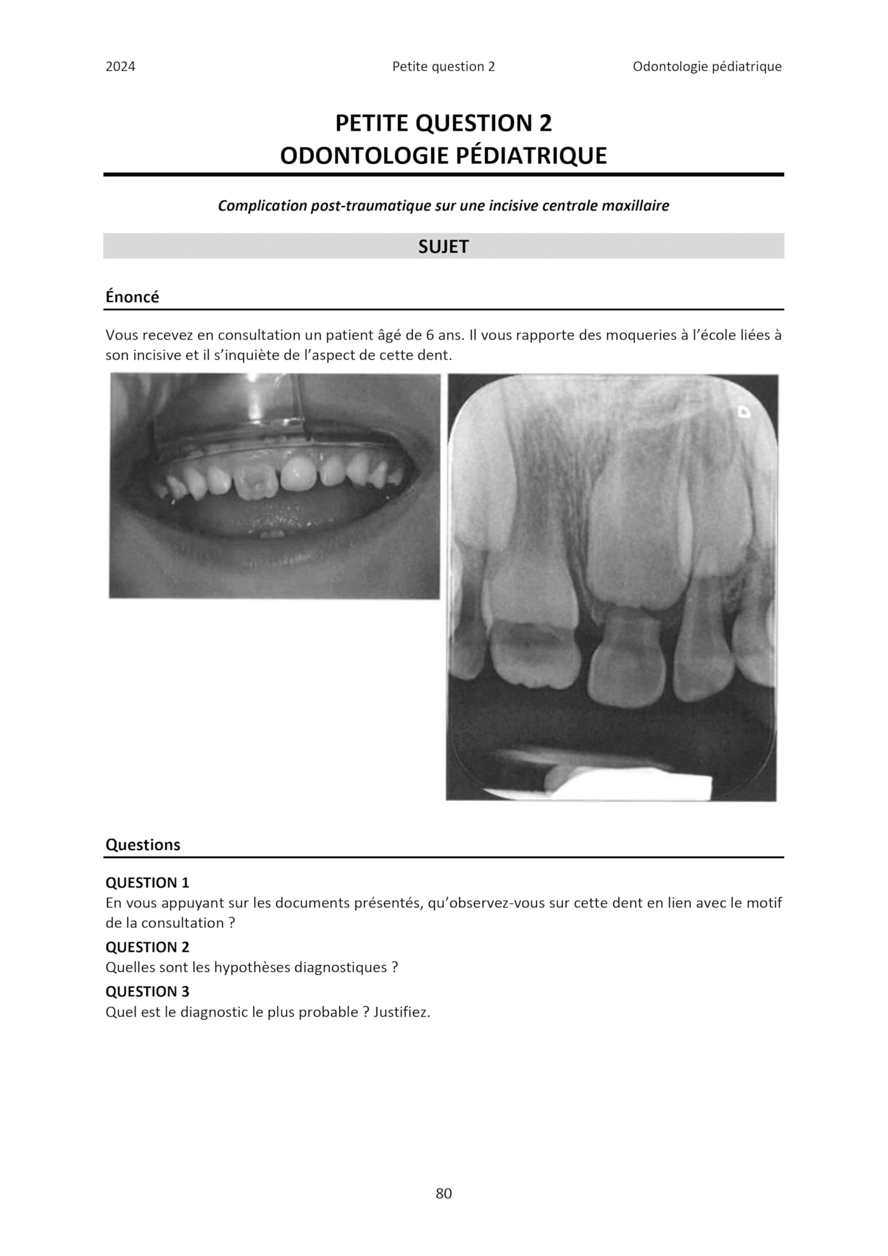 Annales corrigées de l'internat en odontologie 2023-2025