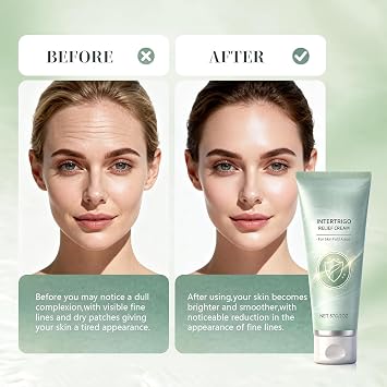 New Intertrigo Cream,Professional Intertrigo Relief Cream,Skin Fold Care & Chafing Support Creams,Helps Soothe Irritated Skin,Moisture & Friction Control,for Friction-Prone Areas 2 oz