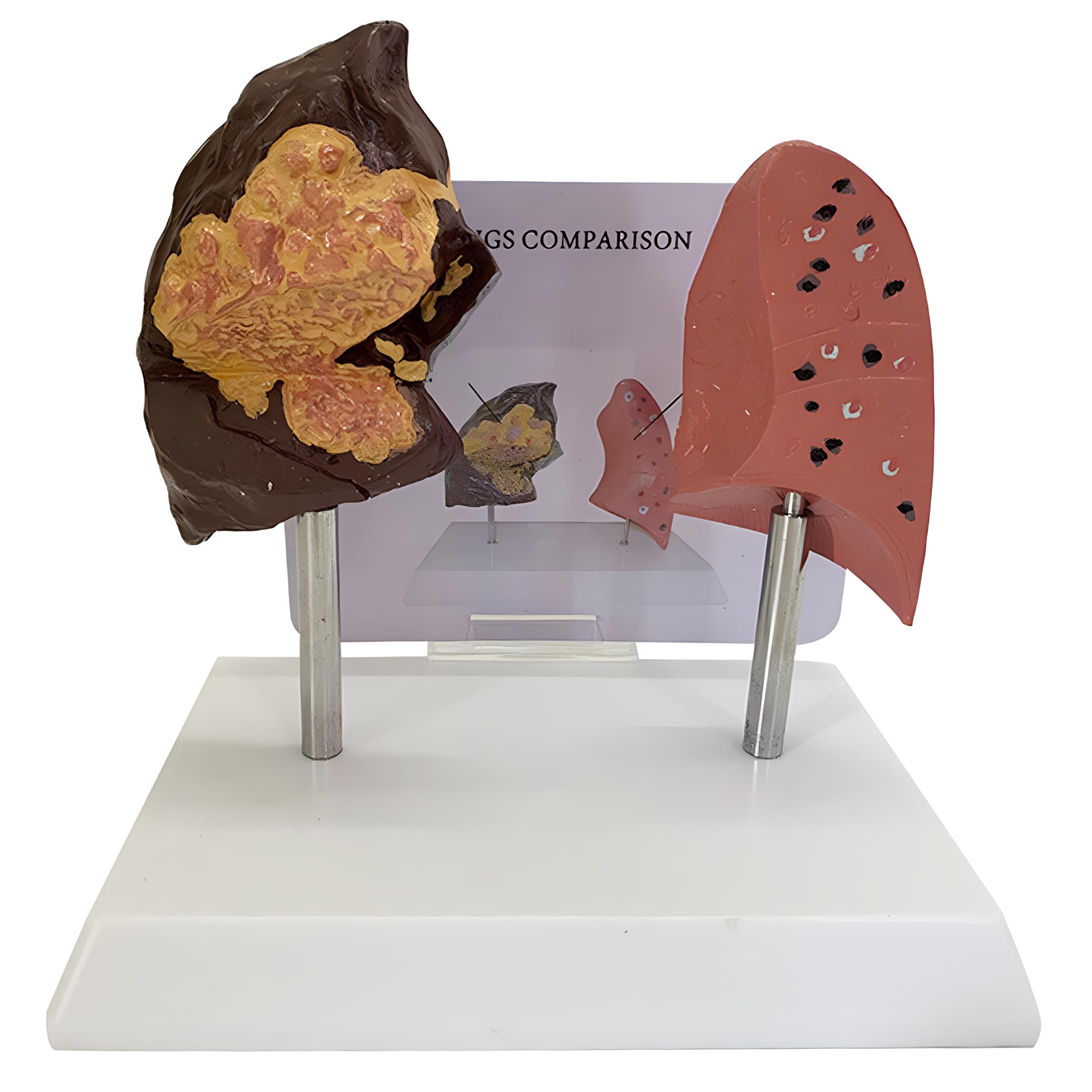 Yanhao Smokers Lung Versus Regular Lung Model Pvc Human Lung ...