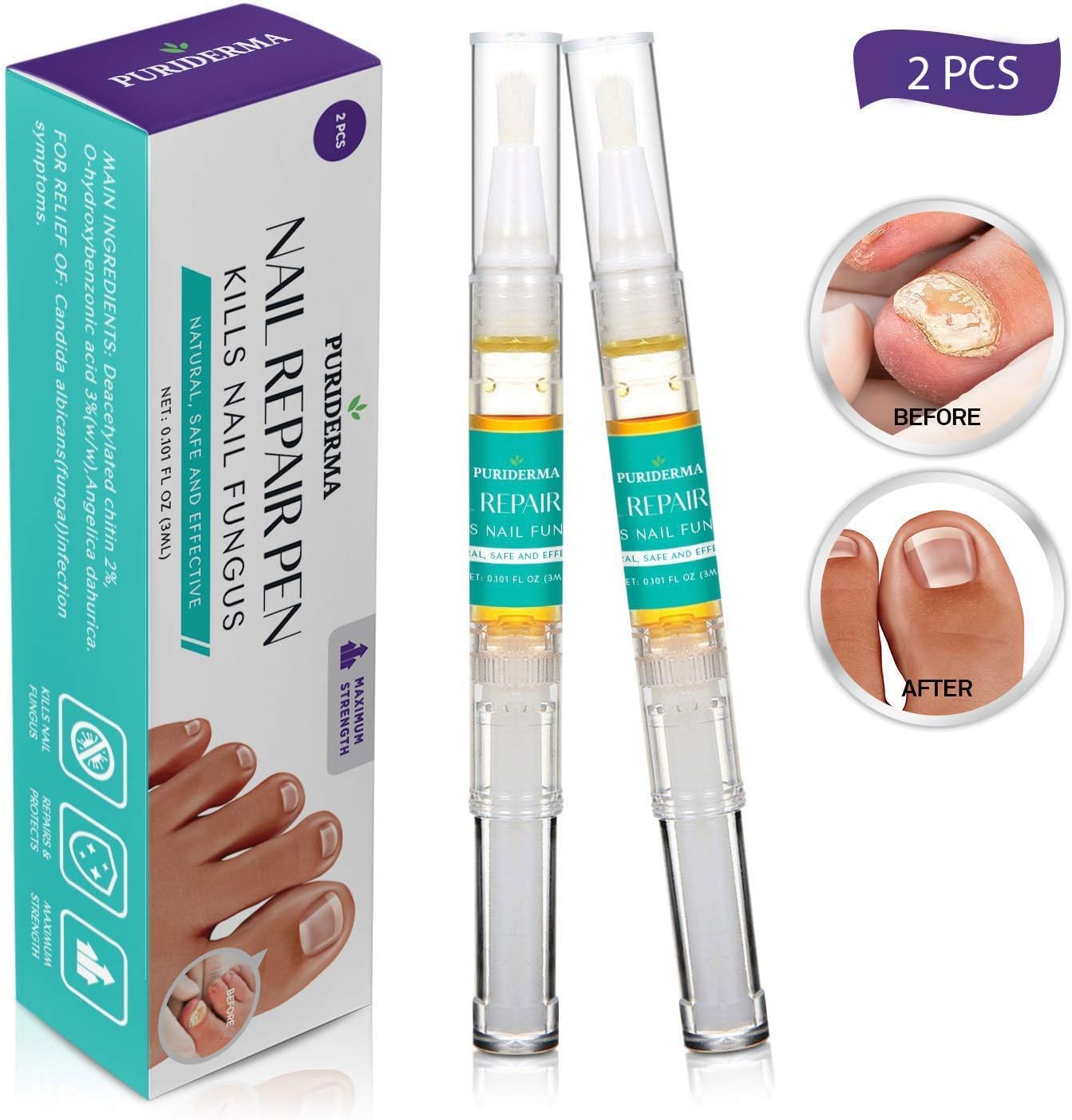 Fungus Stop, Anti fungal Nail Solution Kills Fungus on Toenails