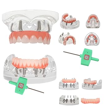 Dental Implant Model, Upper/Lower Jaw, Transparent All-on-4 Overdenture, with 4 Implants Modle M6001-1+M6027 Kit
