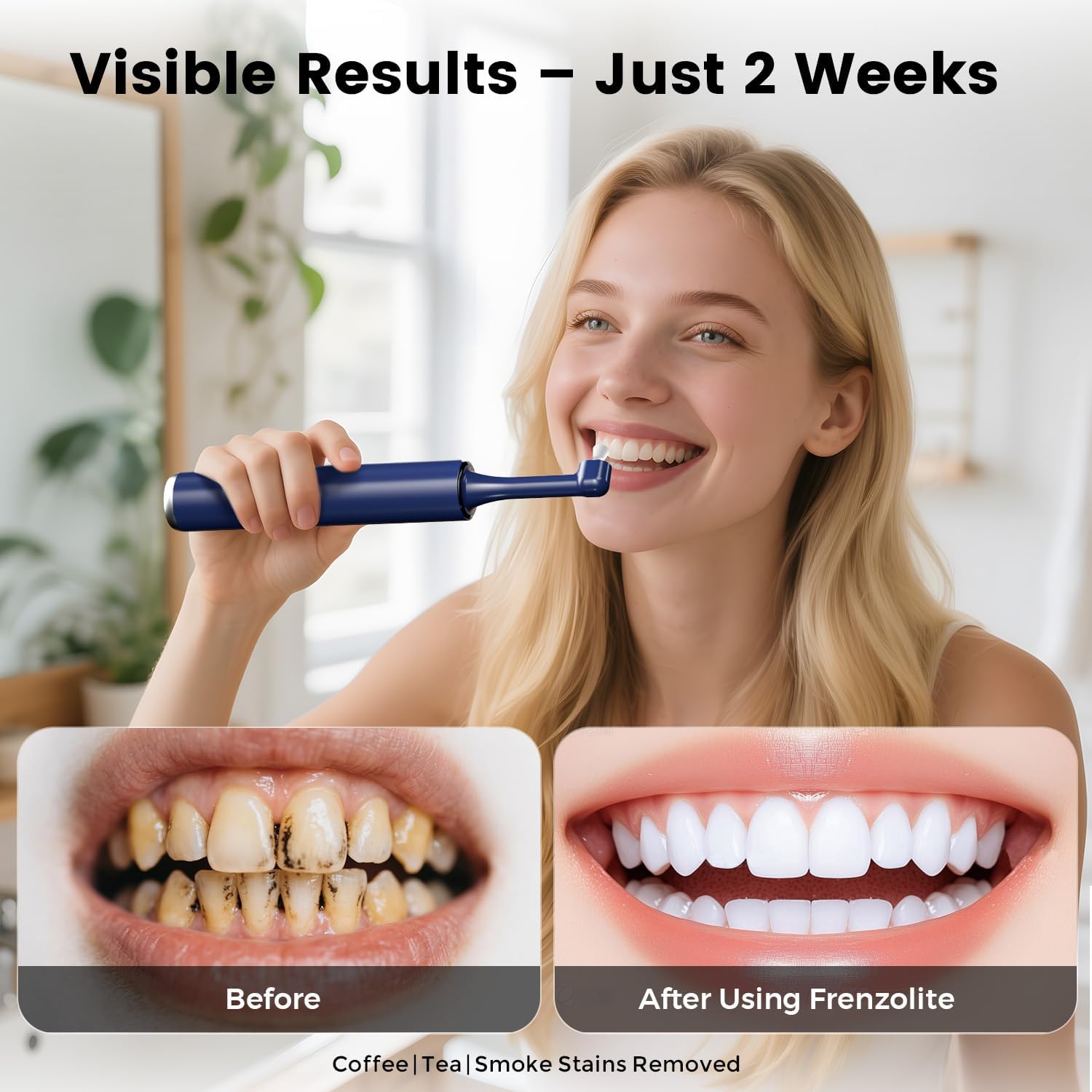 Dental Polisher for Teeth, Rechargeable Tooth Polishing Kit with 5 Speeds, LED Light, 5 Brush Heads & Paste, Teeth Cleaning Tool for Home Use, Helps Remove Coffee & Tea Stains