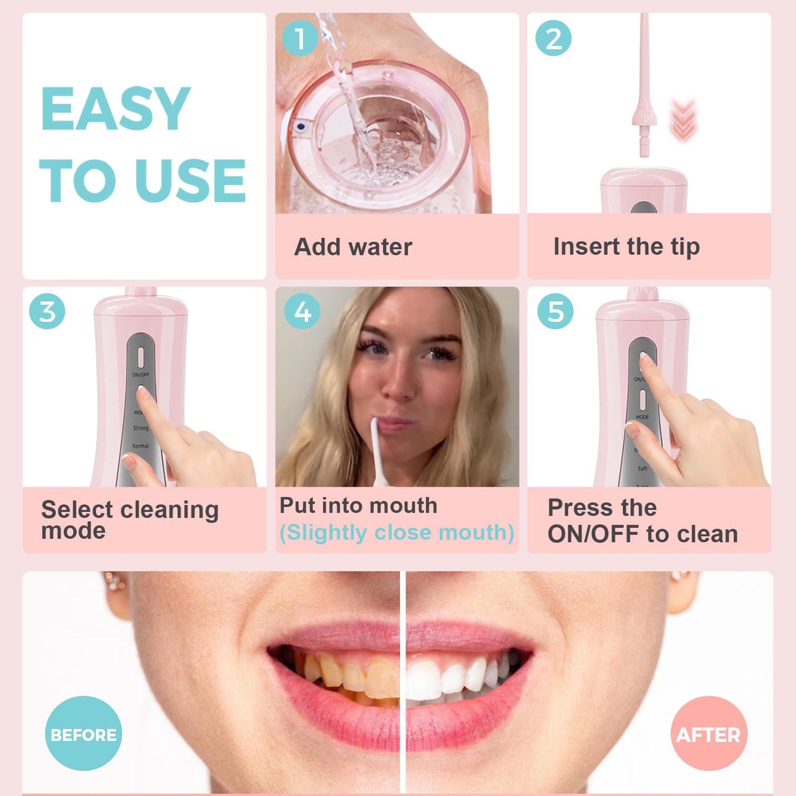 Idropulsore dentale per denti da 350 ml, con borsa da viaggio, 5 modalità di irrigatore orale portatile senza fili, ricaricabile, IPX7, impermeabile, per casa e viaggi (rosa)