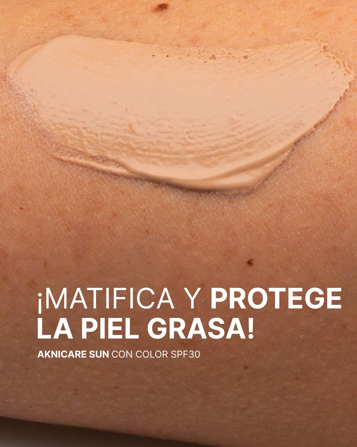 Synchroline - Aknicare Sun Teintée Spf30 Crema Facial Colorada 50 Ml Anti Imperfecciones Piel Mixta y Grasa Con Ácido Hialurónico y Filtros Solares, Made In Italy