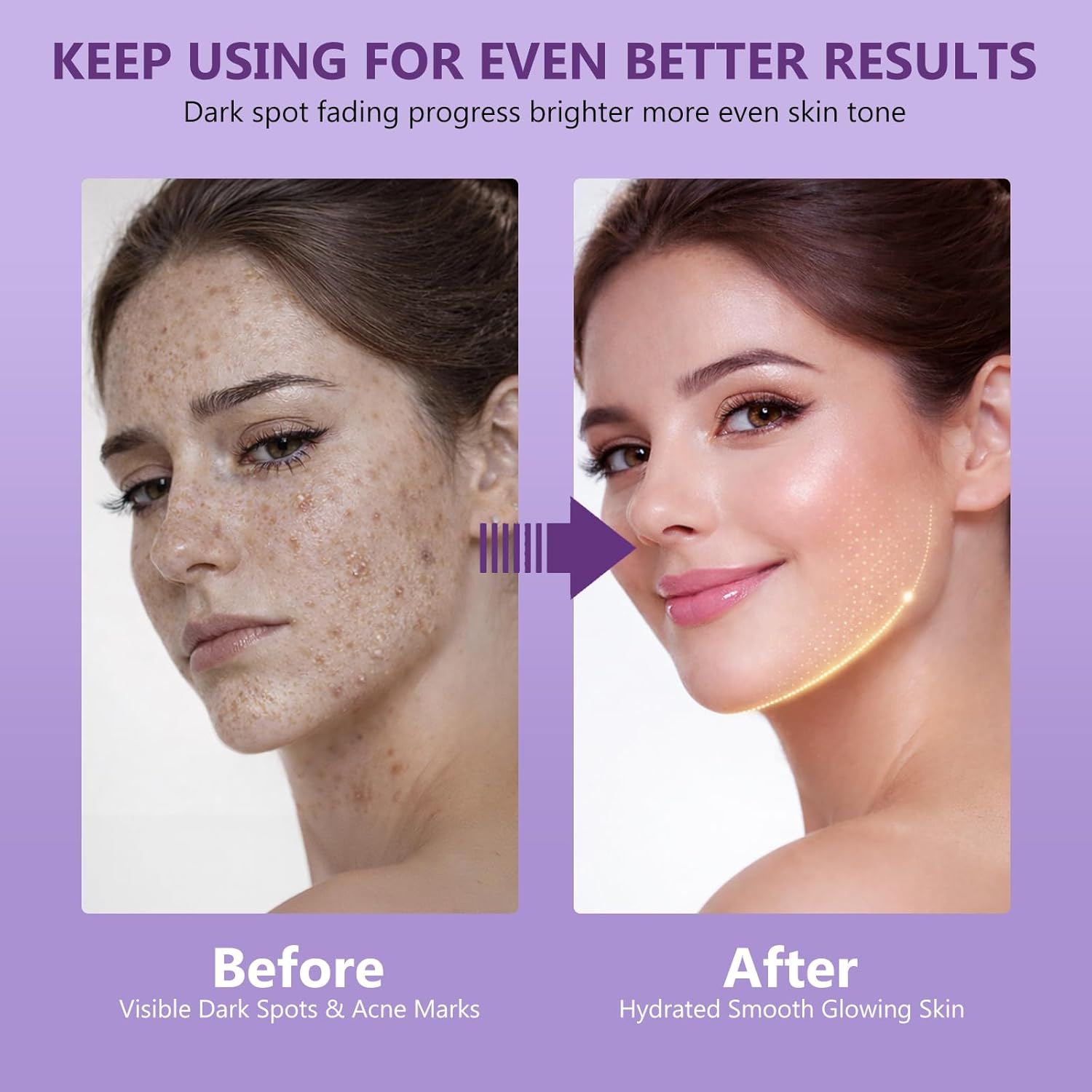 Tranexamîc Acid Serum - Advanced Discoloration Correcting Formula with Niacinamide & Licorice Root Extract - Hydrating ḏark spọt Aftercare for Face & Neck to Even Skin Tone, 1.7 Fl Oz - Image 8