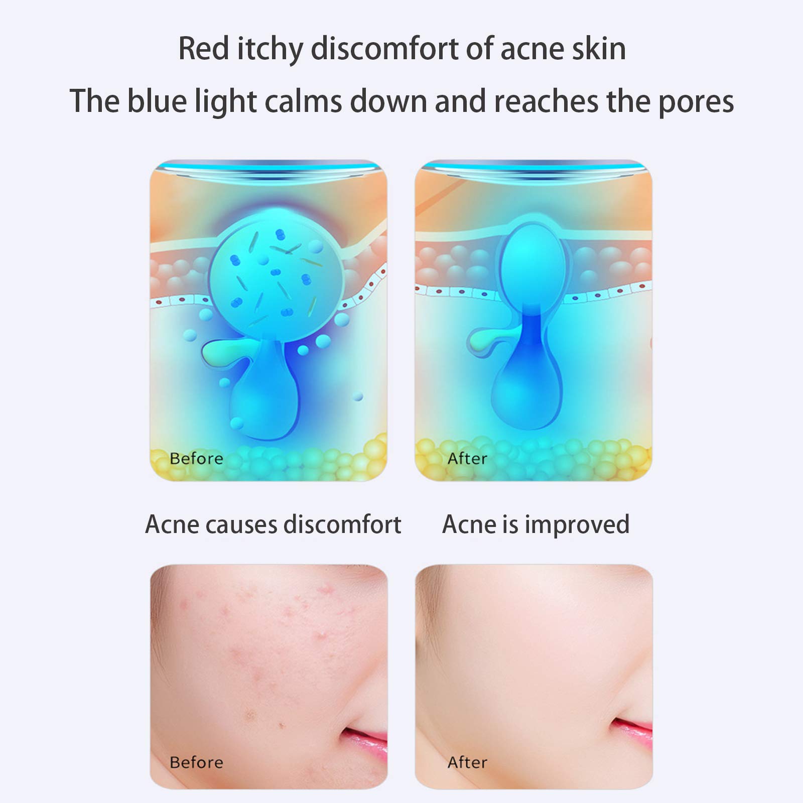 Macchina per la cura del viso EMS Micro Current 3 colori Photon Acne Wrinkle Remove Cellulite Reduction Skin Strighten Fat Burning Slimming Beauty Device Elitzia ETC815