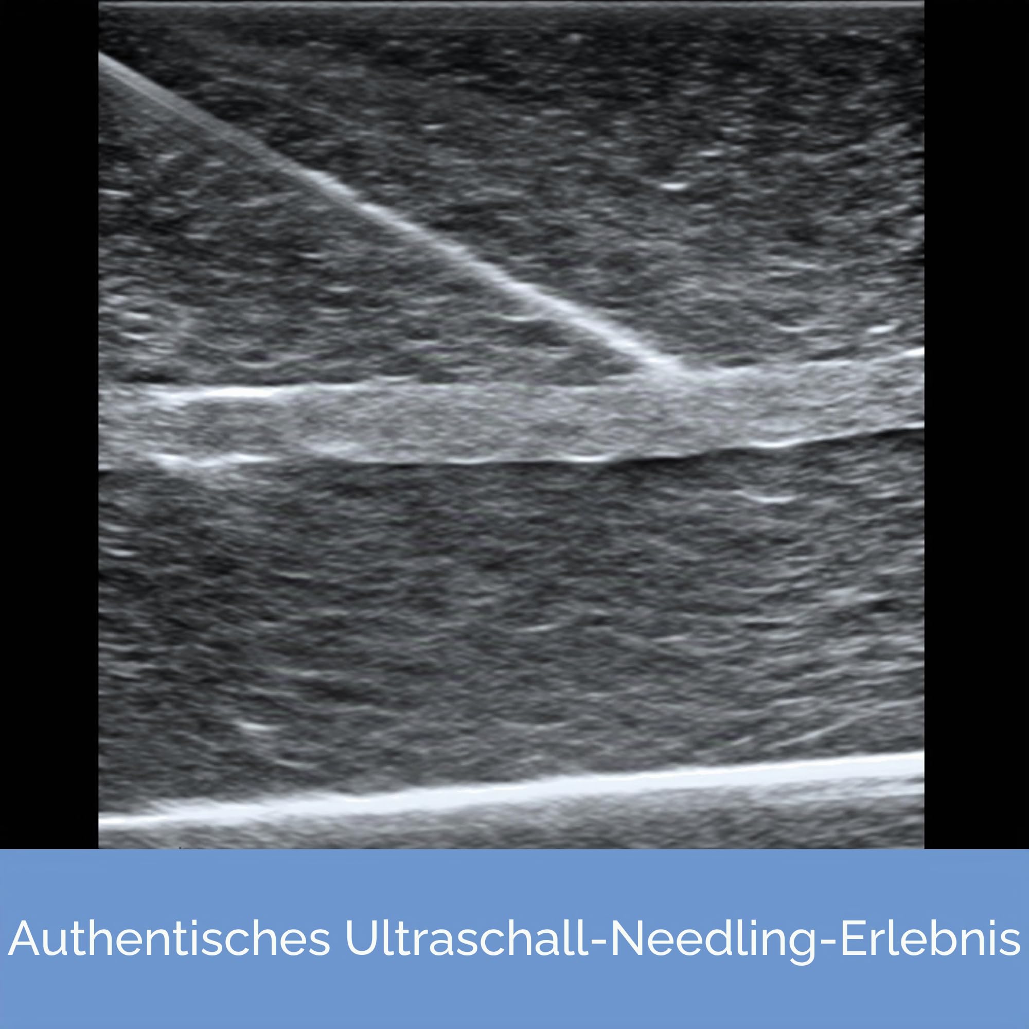 Ultraschall-Phantom-Trainingsmodell für die medizinische Praxis, Nervenblocksimulation (Nervenmodell)