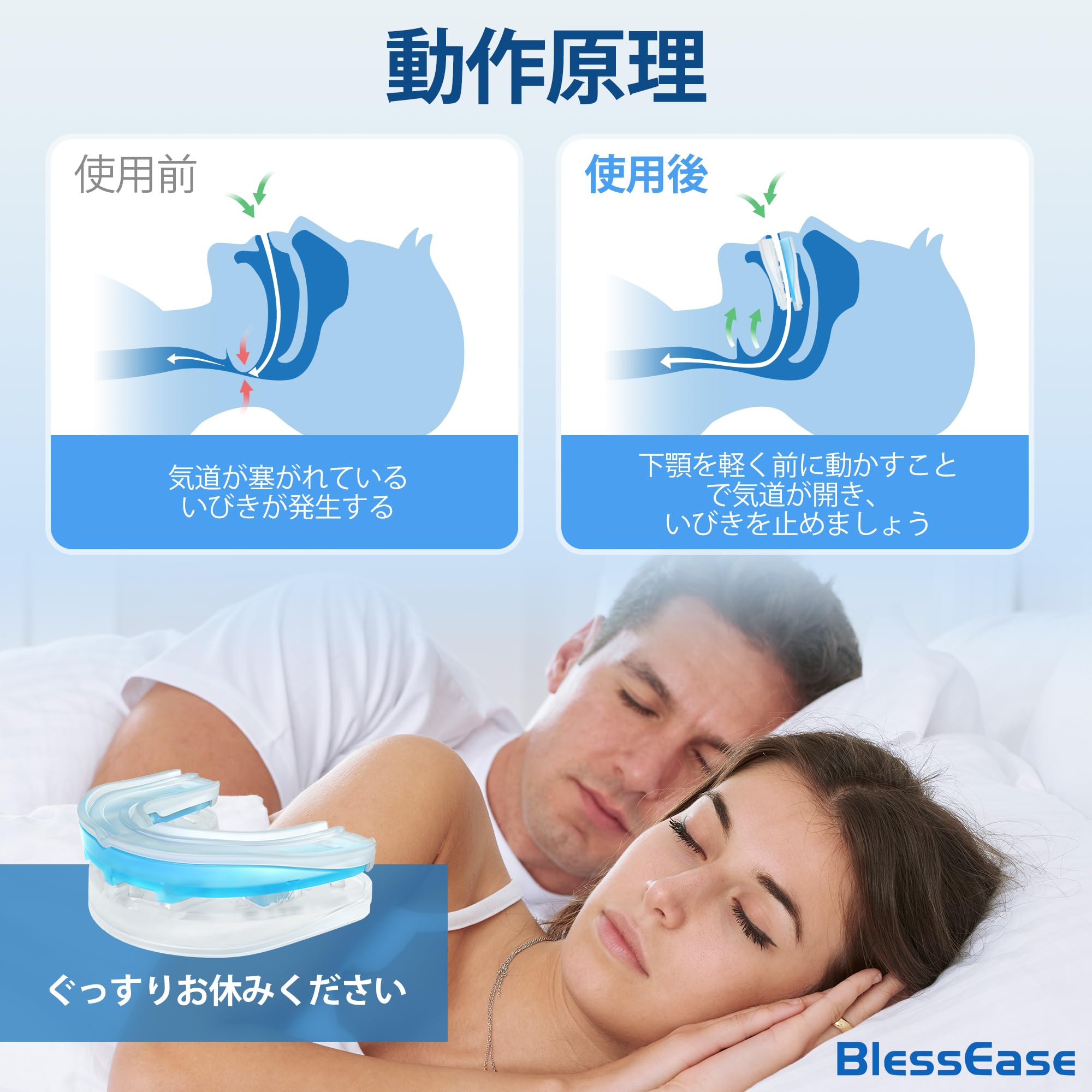 Amazon.co.jp: BlessEase いびき マウスピース いびき防止グッズ 成形