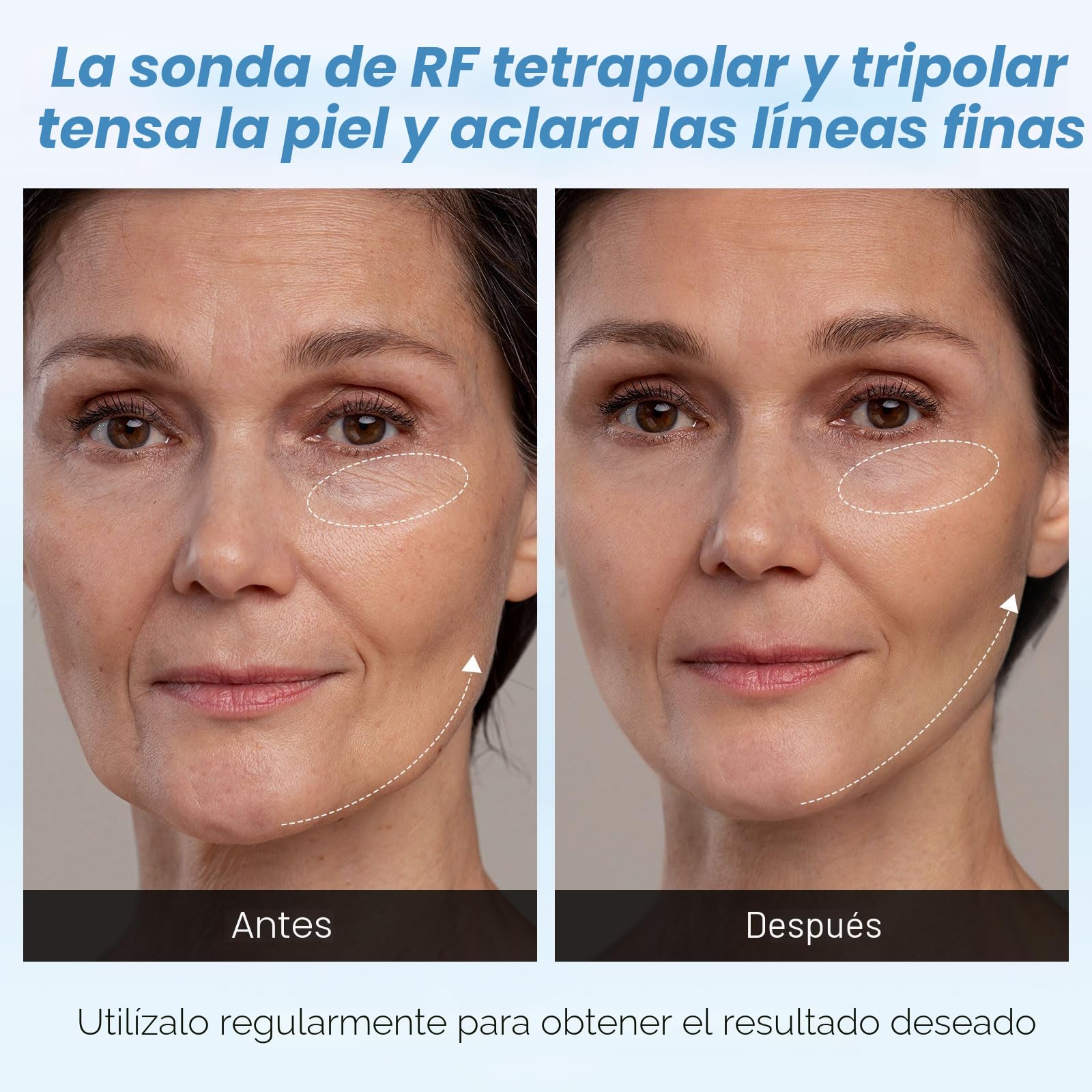 Anticelulítico 4 en 1 40K Cavitación y radiofrecuencia | 10 niveles, pantalla táctil, luz roja y calor, rostro y cuerpo, cuidado en casa