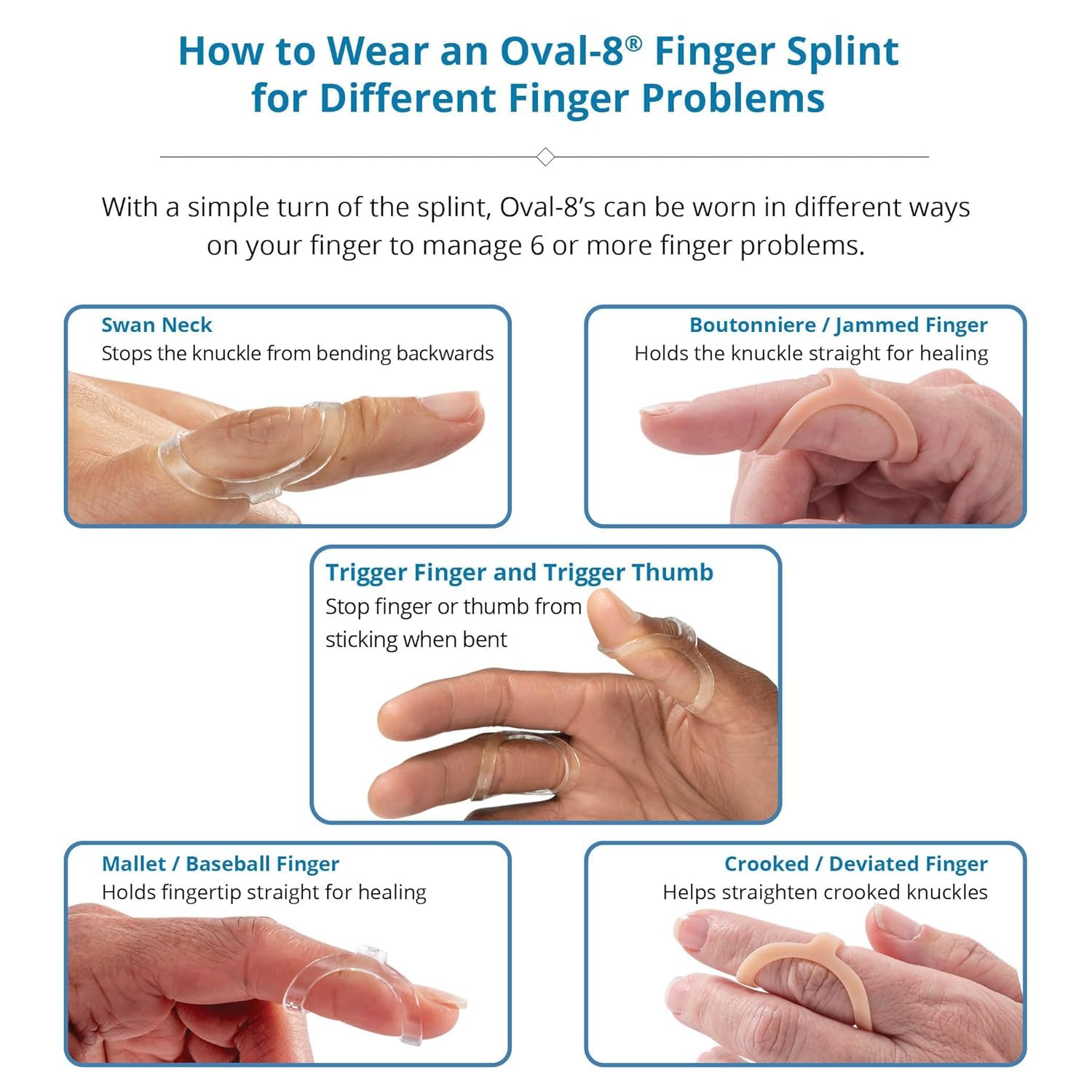 3-Point Products Oval-8 Finger Splints Sizes 8 9 10 Pack of 3 Beige | Support and Protection for Arthritis Trigger Finger or Thumb and Other Finger Conditions product thumbnail 6