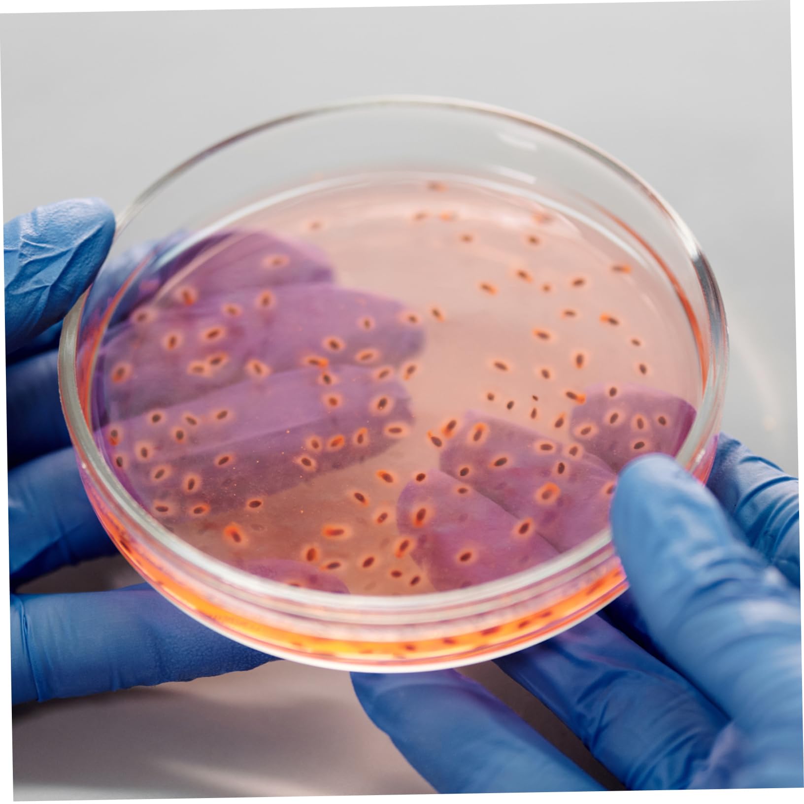 Gatuida 15piezas Placas De Cultivo De Transparente De Platos De Laboratorio Para Observación De Muestras Tapa Para Uso Científico y Cultivo Celular
