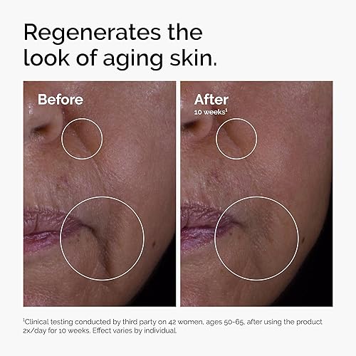 Miniatura 4 de The Ordinary GF 15% Solución, fórmula antienvejecimiento para piel visible y reparación de arrugas, 1 onza líquida