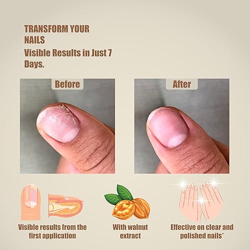 Miniatura 4 de Gel Reparador y Fortalecimiento de Uñas y Cutículas  Resultados en 7 días  Hidrata, endurece y añade brillo  Eficaz con o sin esmalte de uñas  0.1