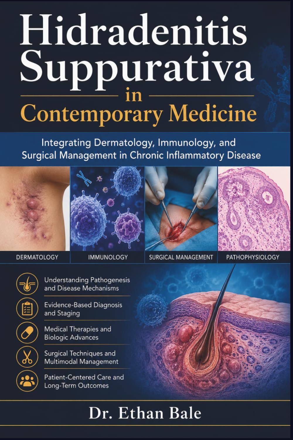 Hidradenitis Suppurativa in Contemporary Medicine: Integrating Dermatology, Immunology, and Surgical Management in Chronic Inflammatory Disease