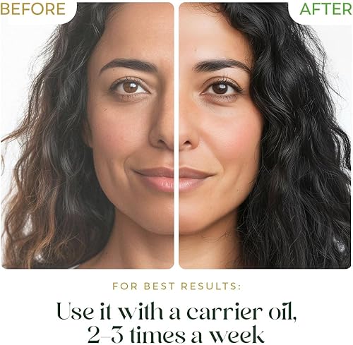 Miniatura 7 de HerbsIndia Aceite esencial de árbol de té para la piel, enorme 3.3 onzas, 100% puro, grado prémium con cuentagotas de vidrio, sin diluir, sin OMG