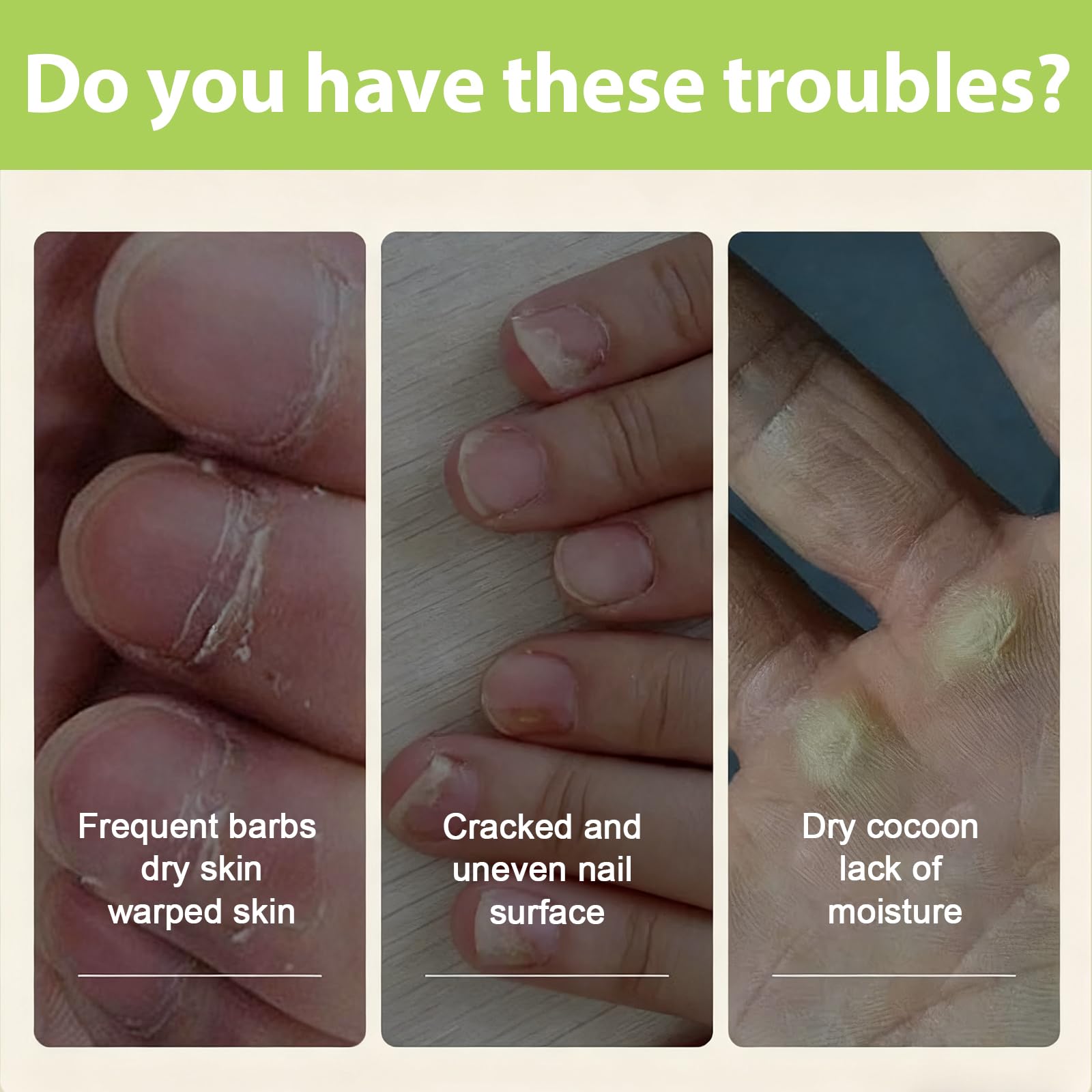 20ml Olio per Unghie e Cuticole,Cura Delle Unghie Olio,riparazione per unghie Fragili olio,Nutre,Rafforza e Idrata le Cuticole e Unghie,Cura per Mani e unghie