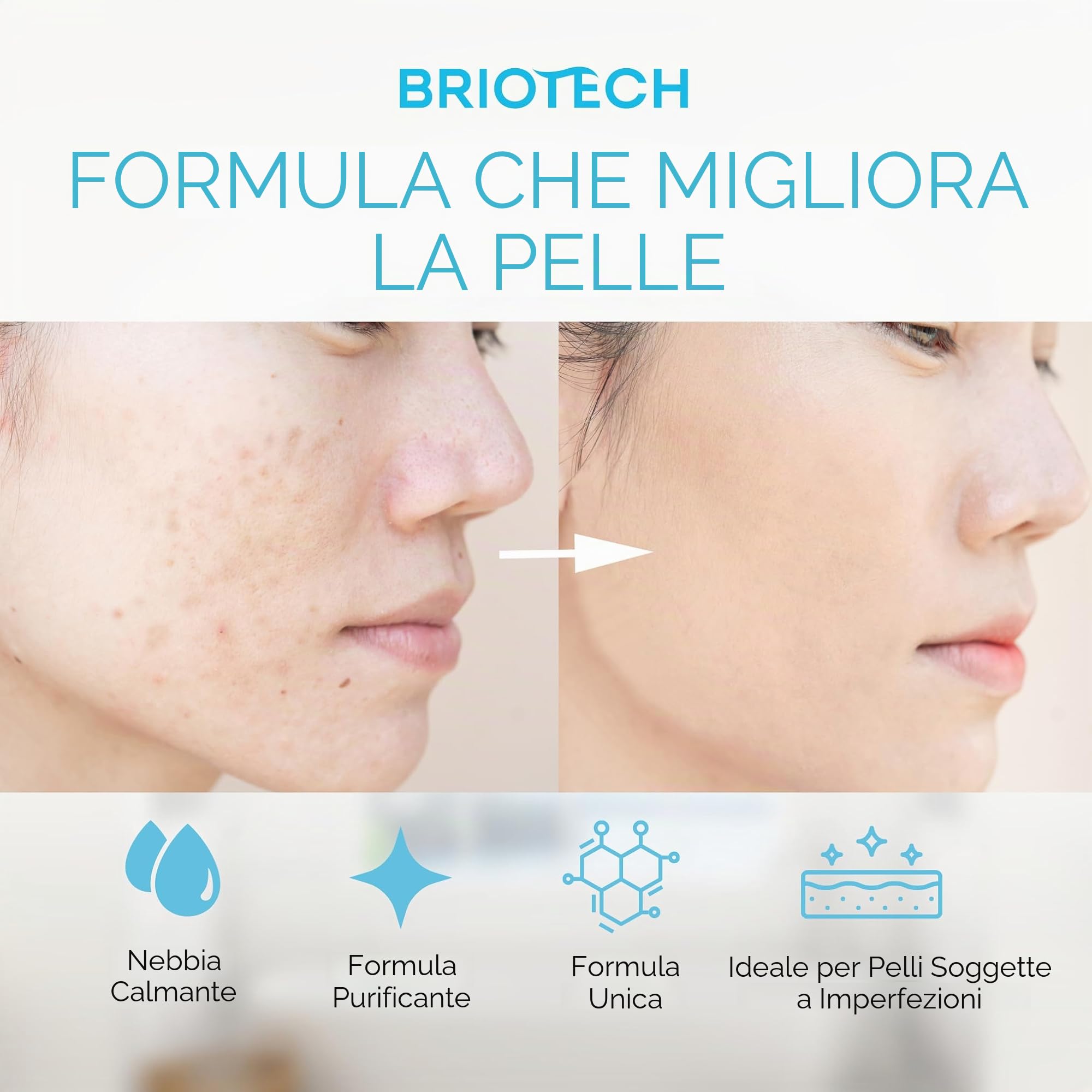 BRIOTECH Spray Toner per il viso - Acido Ipocloroso Puro HOCl - Nebbia Lenitiva per tutti i tipi di pelle - Skin Renew - 100