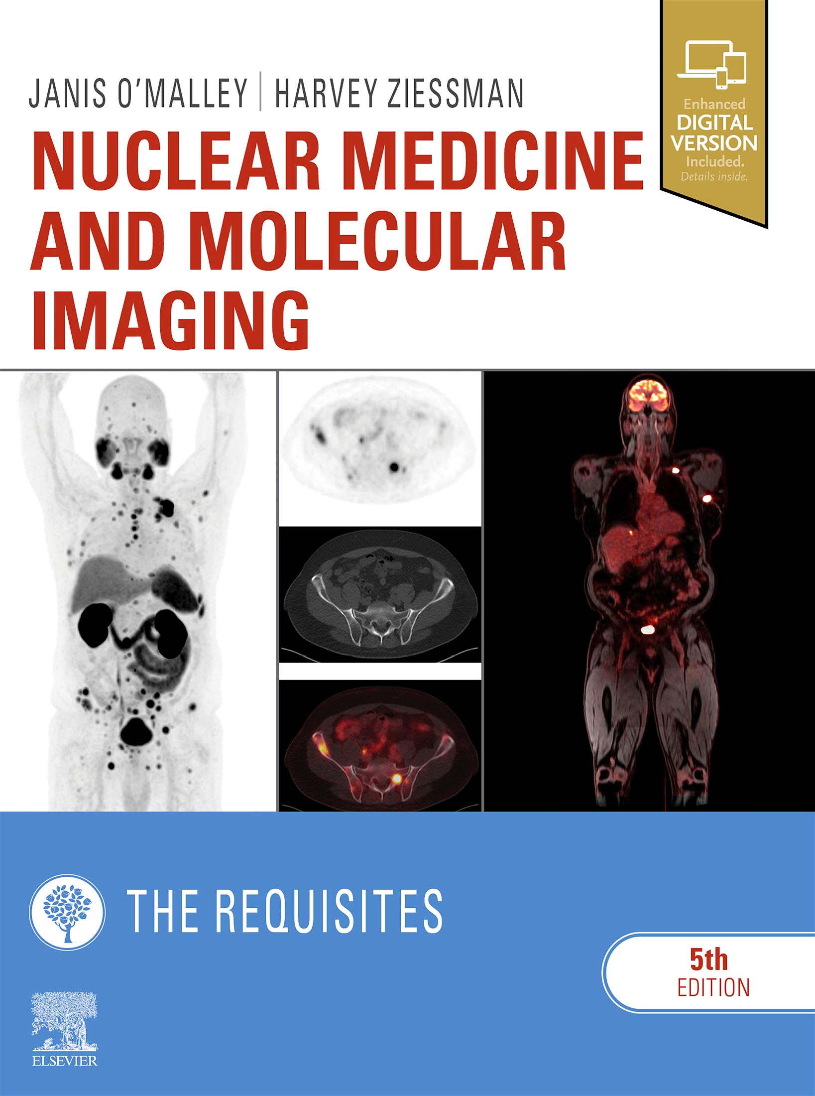Nuclear Medicine and Molecular Imaging: The Requisites E-Book (Requisites in Radiology)