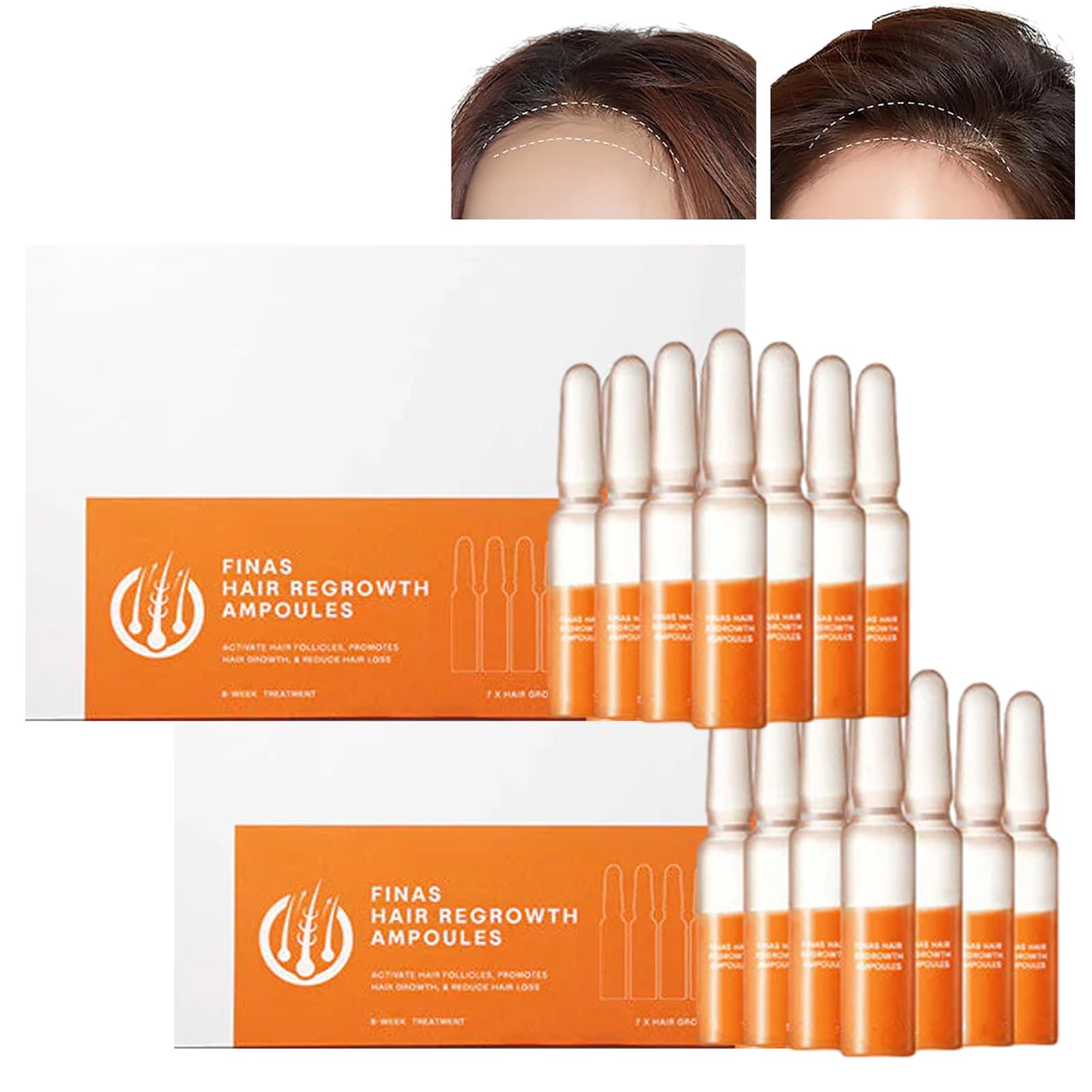 Liasc FINAS Prestig Hair-Regrowth Ampoules,Liasc Hairmuch Hair Growth Ampoule Serum Lotion,Biotin Hair Growth Serum,Hair Loss Thickening Regrowth for Thinning Hair (14 pcs/2 boxes)