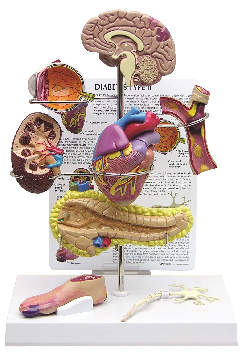 Modèle De Diabète Modèle Visuel Modèle D'hypertension Modèle De Diabète Cerveau, Oeil, Coeur Huit Organes