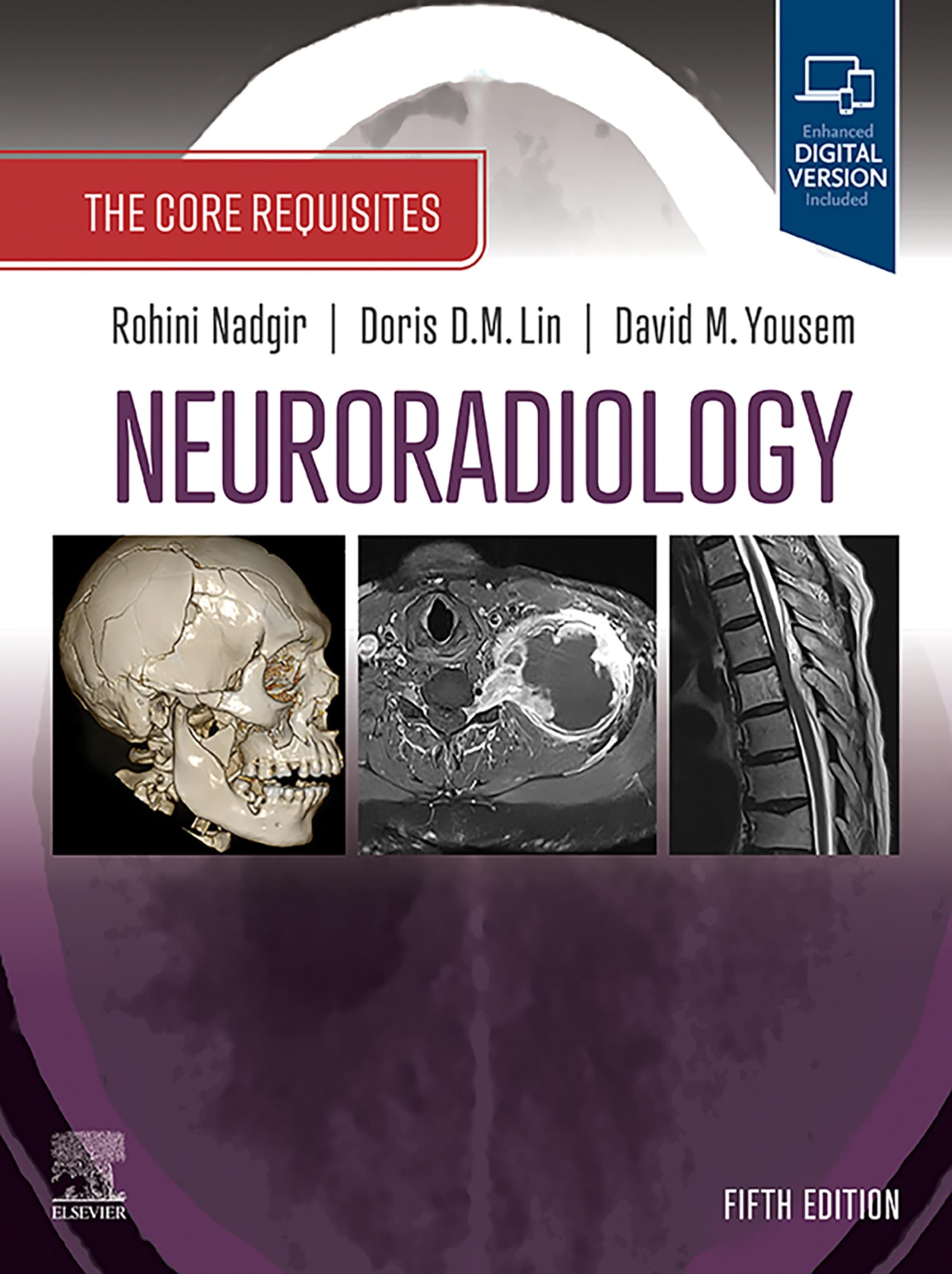 Neuroradiology: The Requisites E-Book: The Core Requisites (English Edition)