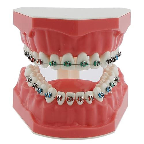 Modelo de ortodoncia Modelos dentales 11 Dientes de Typodont estándar Modelo M7010-2 Demostración Enseñar estudio con lazos de ligadura Archwire