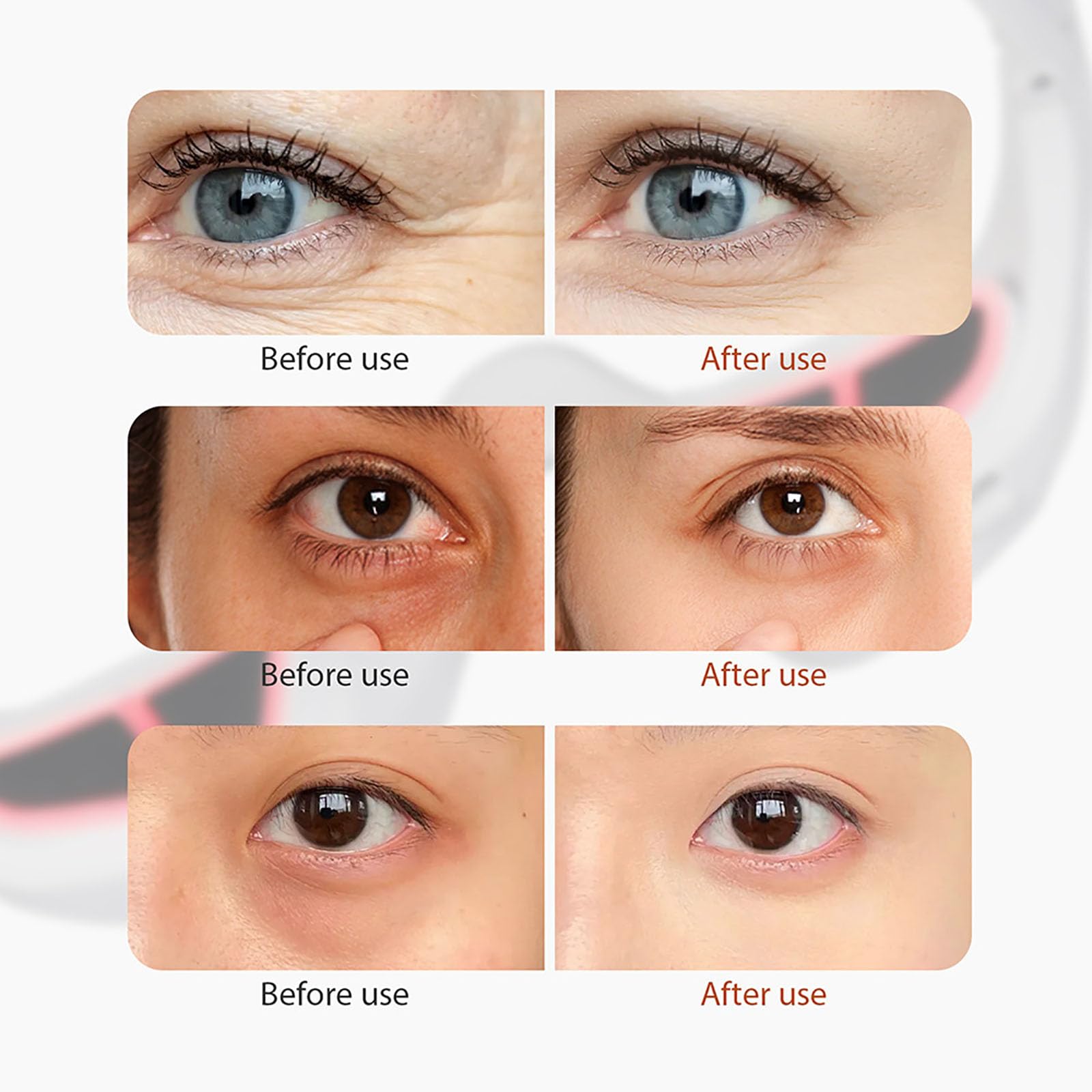 Dispositivo Renewa Eyelift, gafas de terapia de luz roja de ojo para removedor círculos oscuros ojos hinchazones Reducción de arrugas de bolsas, ojos de lente levantamiento masajeador (1Set)