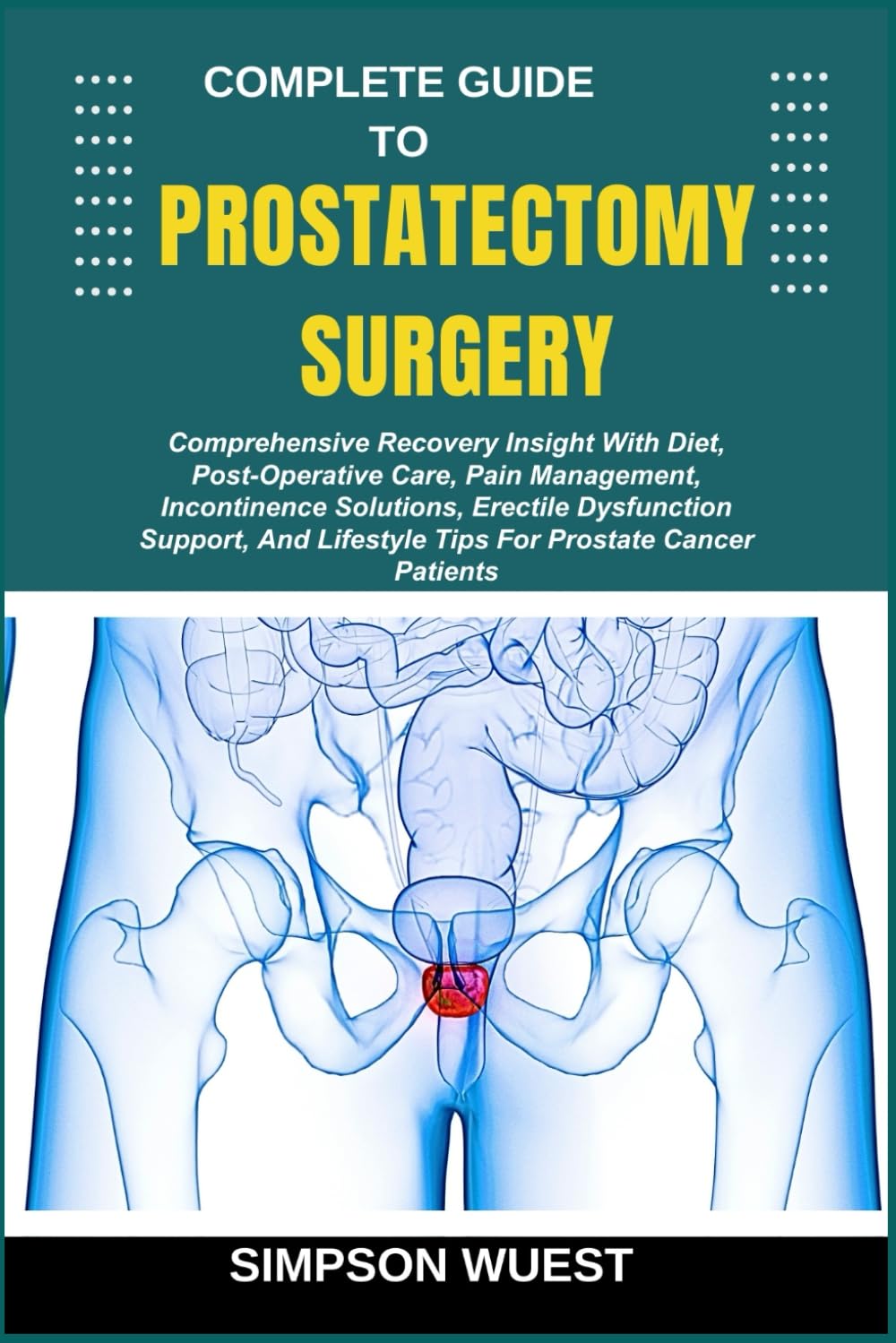 COMPLETE GUIDE TO PROSTATECTOMY SURGERY: Comprehensive Recovery Insight With Diet, Post-Operative Care, Pain Management, Incontinence Solutions, ... Lifestyle Tips For Prostate Cancer Patients