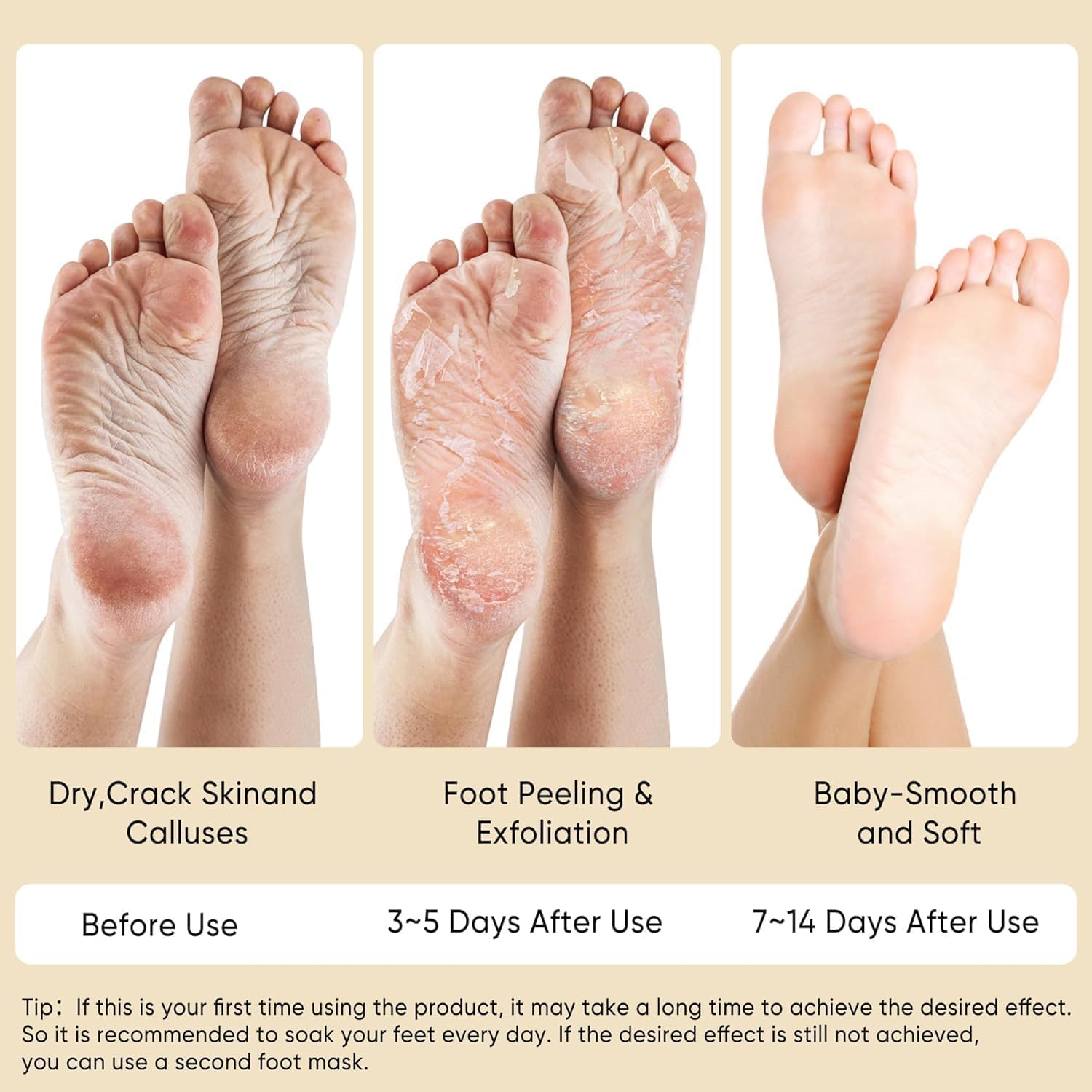 Coconut Oil Hand Foot & Hair Mask Set with Vitamin E – Repair & Moisturize Dry Cracked Skin – Whitening Sheet Masks with Moisturizing Gloves Socks & Hair Mask – For Women & Men – Combo 3 in 1 (Hand, Foot & Hair) 4