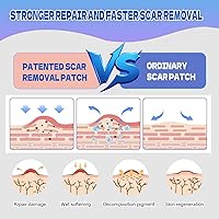 Vista 6 de Hojas de silicona para cicatrices, cinta de silicona para cicatrices, parches de cicatrices de silicona para cicatrices quirúrgicas, cesárea