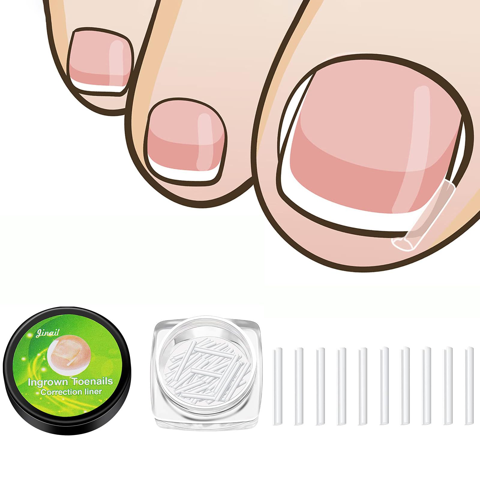 50Pcs Toenail Corrector Strips, Toe Nail Correction Patch, Toenail Braces for Foot