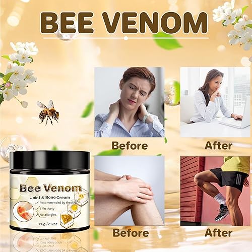 Miniatura 2 de 2 unidades de crema de artritis de veneno de abeja, crema avanzada de veneno de abeja, crema de alivio de articulaciones de veneno de abeja,