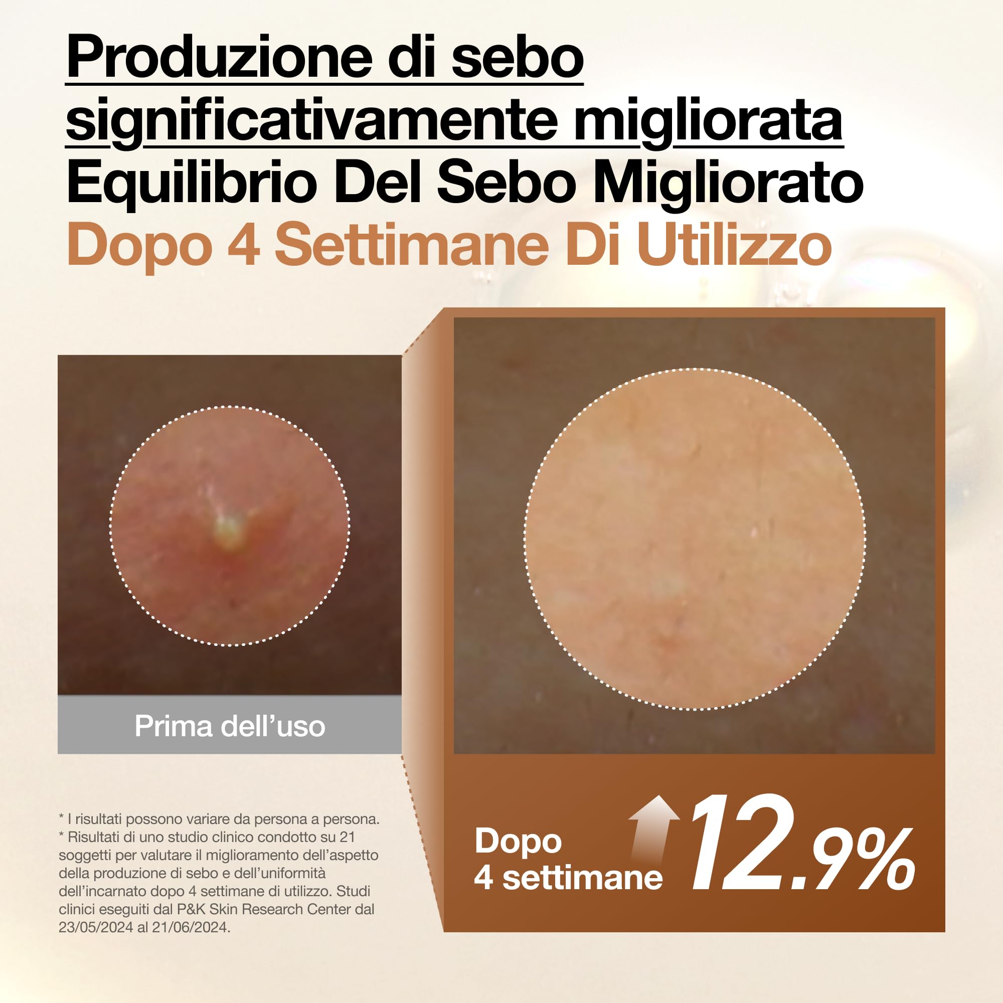 Anua Rice 70 Glow Milky Toner – Tonico Viso Idratante e Illuminante Coreano, con Acqua di Riso 70%, Niacinamide, Ceramidi e Pantenolo, Tonico Lattiginoso per Pelle Sensibile, Non Comedogenico (250ml)