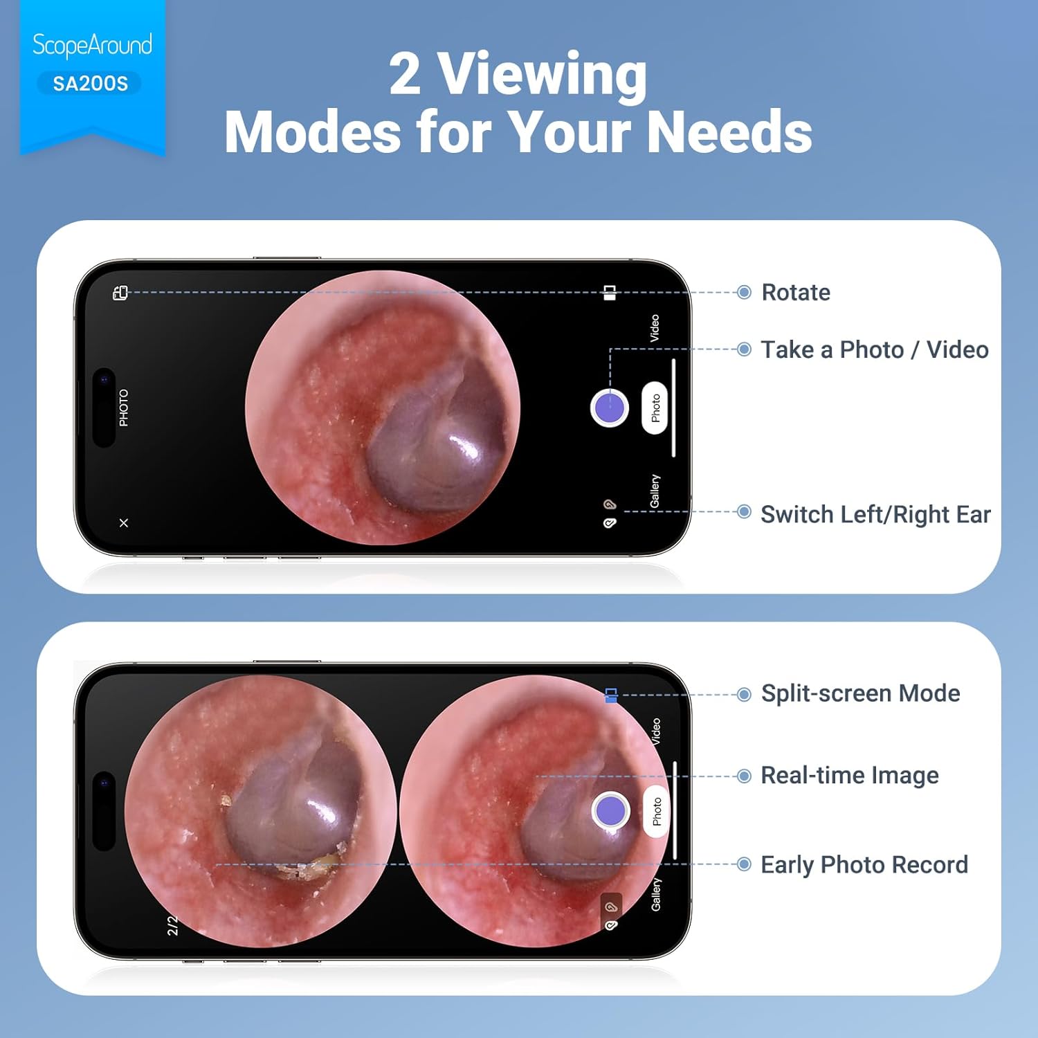 Smartphone screen displaying two viewing modes for the otoscope: a single full-screen view with options to rotate, take photo/video, and switch left/right ear, and a split-screen mode showing real-time image and early photo record.