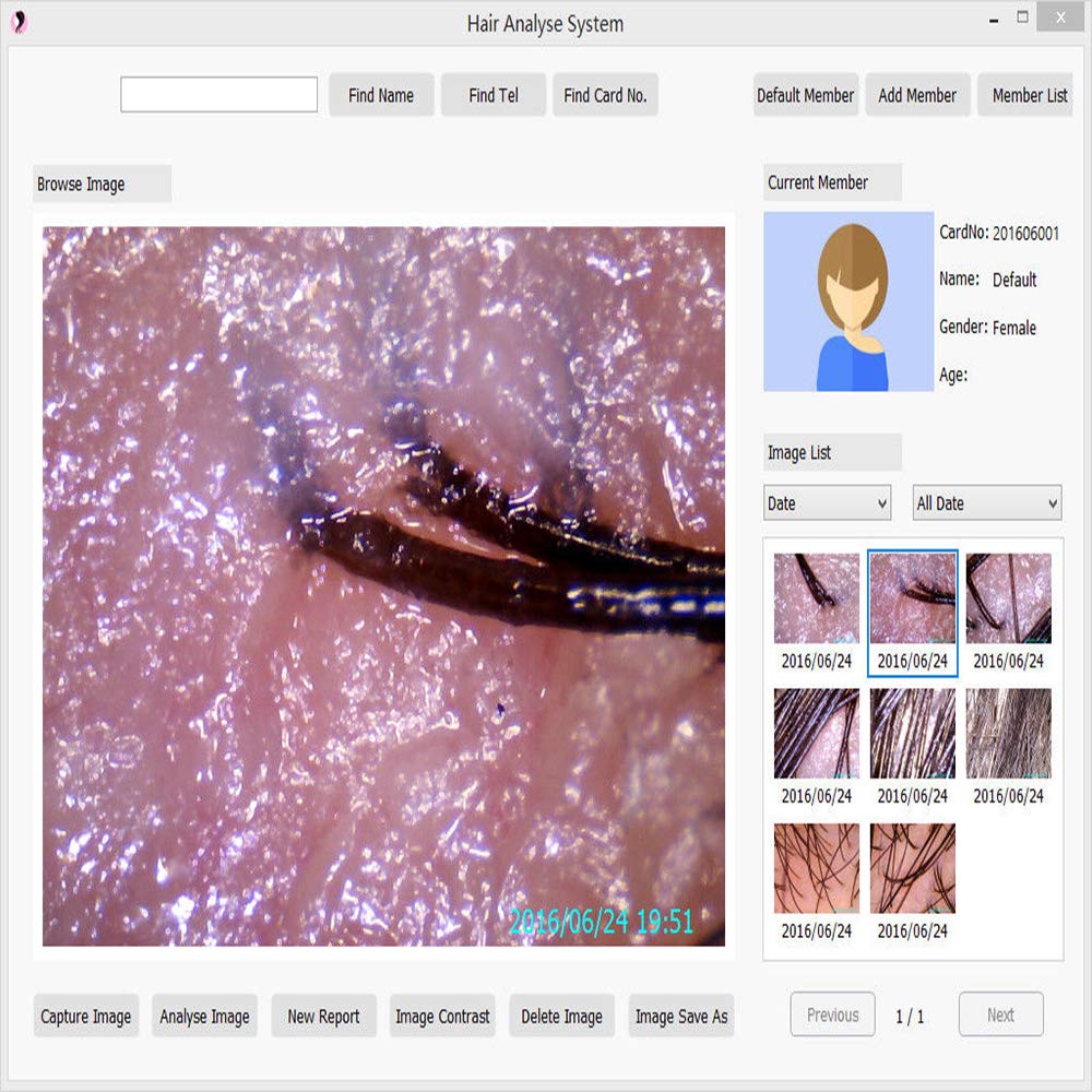 Hair Analyzer, Zinnor Hair Analysis Machine 8.0 MP Digital Hair
