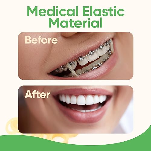 Miniatura 7 de Bandas de goma elásticas ortodónticas de 316 pulgadas, paquete de 100, neón, ligeras de 2.5 onzas, bandas de goma pequeñas para rastas de cabello,