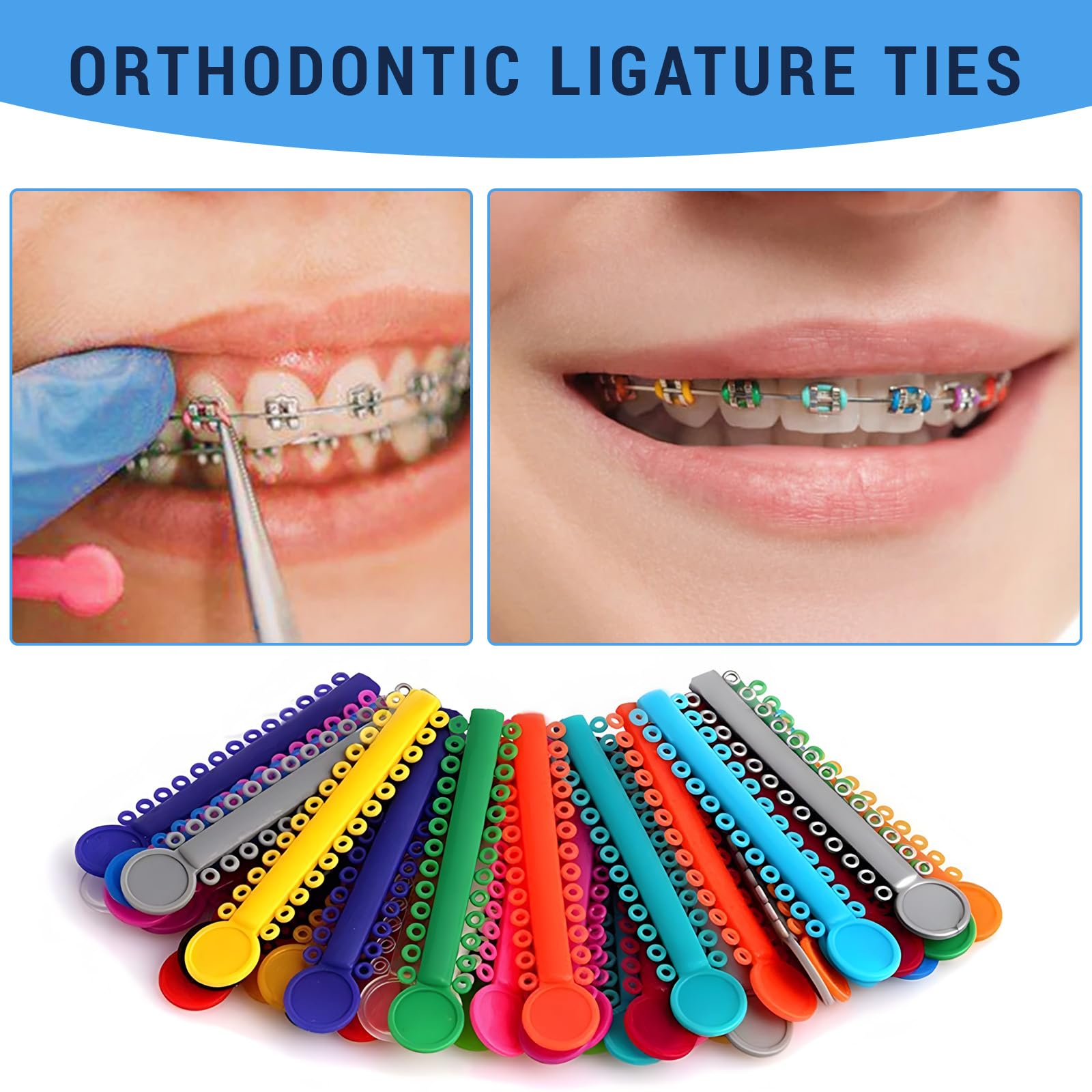 XdealCozyxc 2080 Orthodontic Elastic Bands for Braces (Mixed Colors) - Image 4