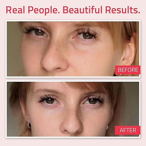 Miniatura 4 de Yeouth Crema de ojos de retinol con ácido hialurónico, crema debajo de los ojos para ojeras e hinchazón, bolsas debajo de los ojos, crema hidratante