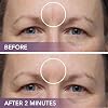 Dermaflage Scar Filler Kit - Medium - Deep Scar Cover and Waterproof Concealer for Acne Scars Wrinkles, and Ice Pick Scars Makeup, 1 mo supply