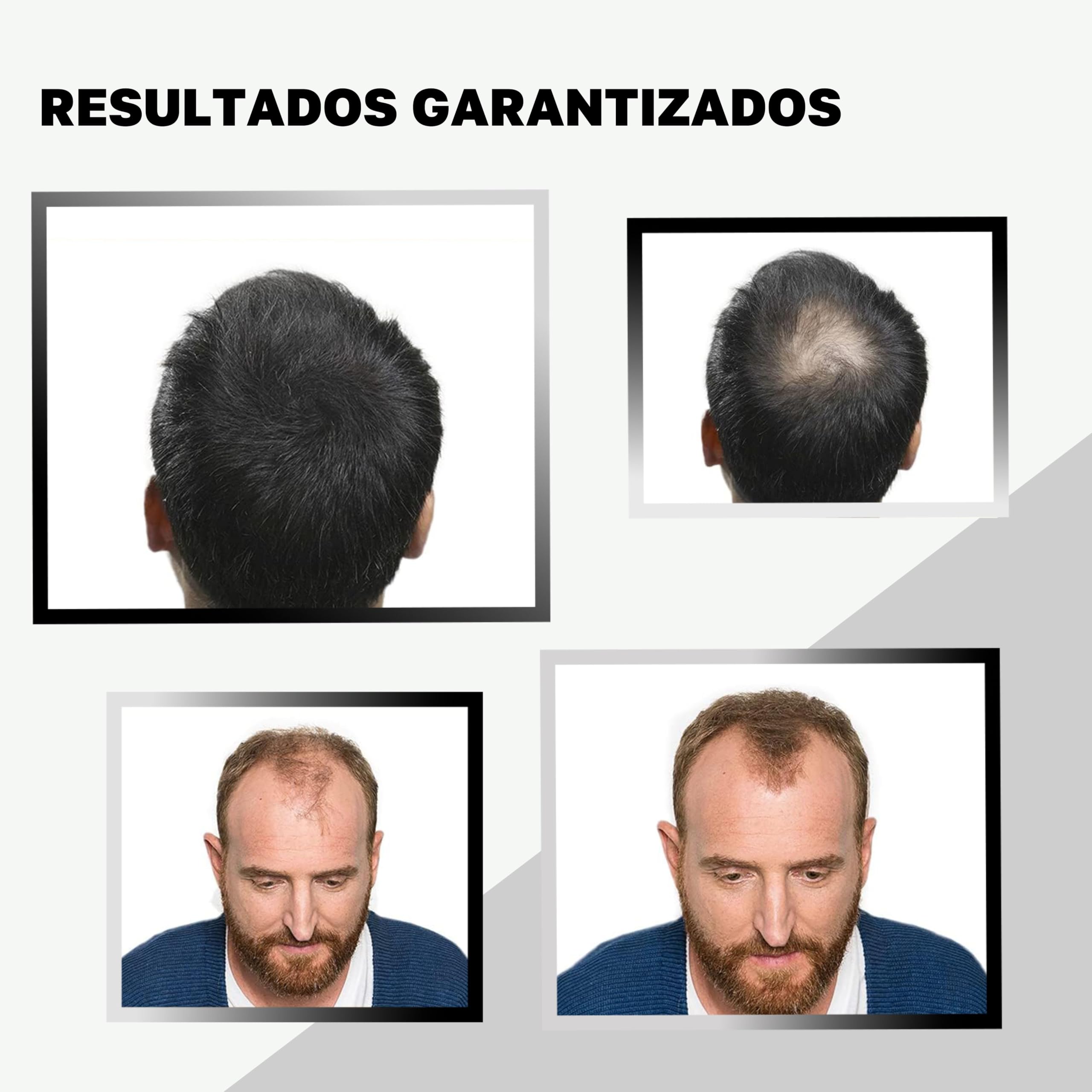 VidalForce Fibra Capilar Negro 60g (Pack 2x30g) 100% de origen Vegetal I Maquillaje Capilar indetectable I Fibras Keratina vegetal I Disimular Calvicie hombre y mujer