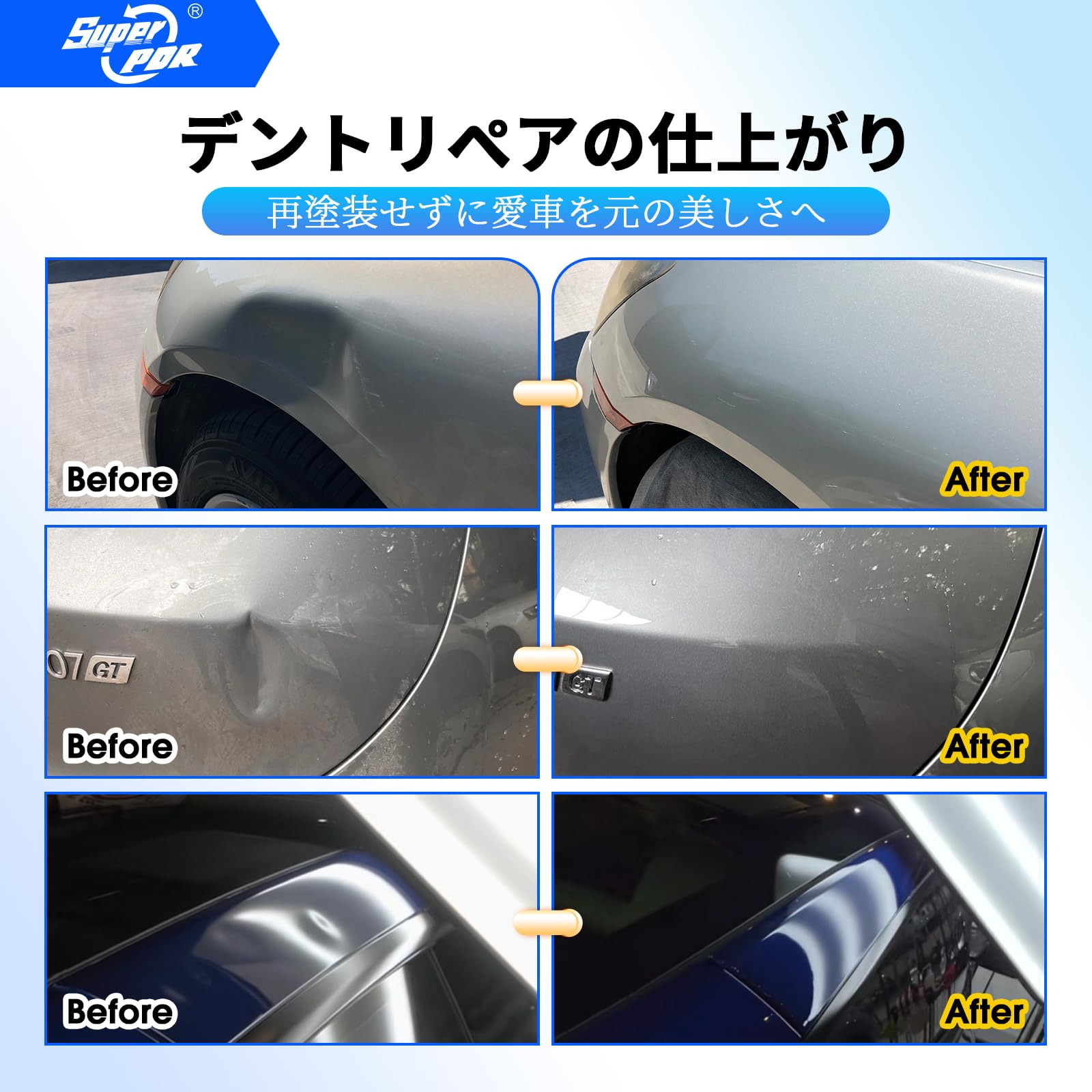 Amazon.co.jp: Super PDR デントリペアツールセット PDR用 車の凹み