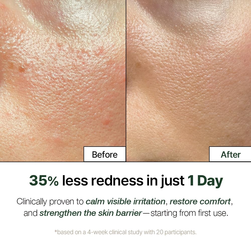 NDP Cica Cream - Gel Face Moisturizer for Sunburn Relief, lightweight Korean Moisturizer for Sensitive Skin, Centella Asiatica, Hydrating, Calming, Soothing (1.7 Fl oz / 50ml) - Image 3