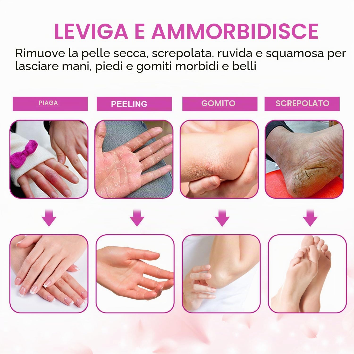Bagno di Paraffina 265 W per Mani e Piedi, Forever Speed Cera di Paraffina Set Elettrico Paraffin Dispositivo Rosa