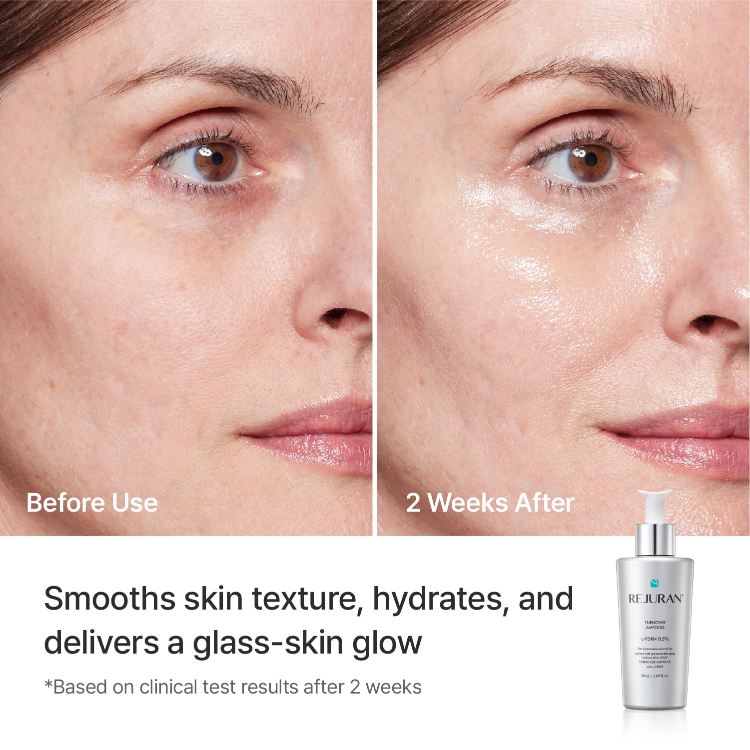 Amazon.com: REJURAN® Skincare Repair Set with c-PDRN® – Turnover