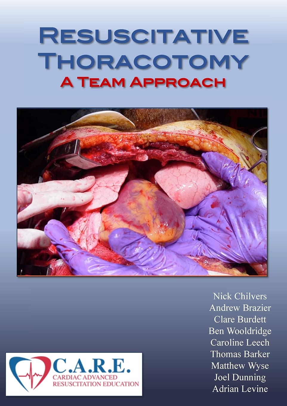Resuscitative Thoracotomy: A Team Approach