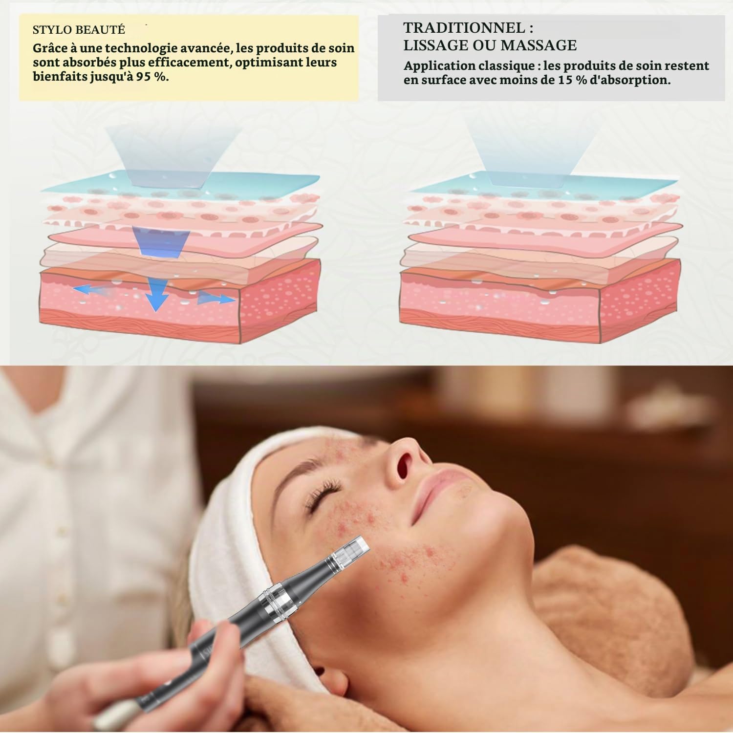 PELCAS Stylo Beauté Microneedling, Appareil de Soin du Visage et du Corps avec 3 Vitesses et 12 Cartouches de Remplacement, Rechargeable