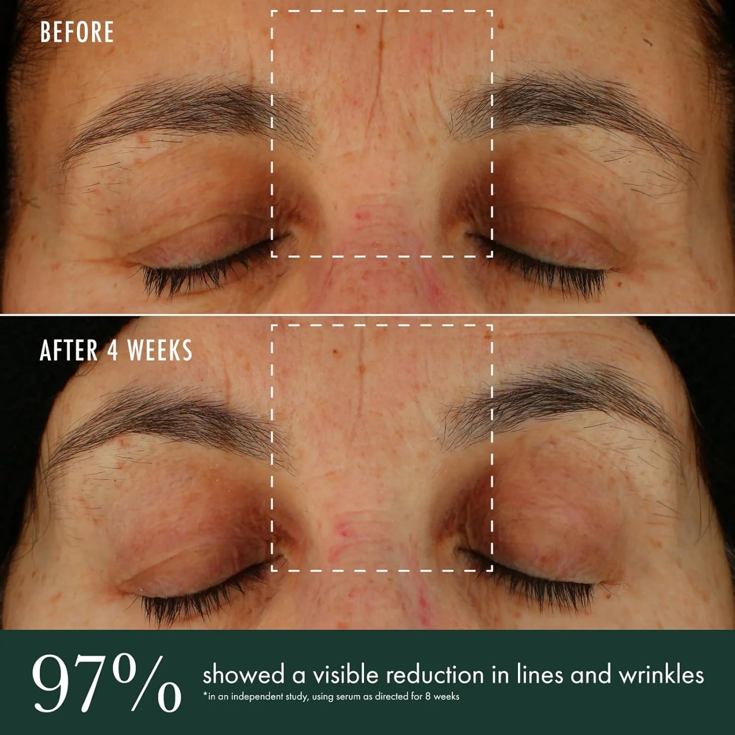 RéVive Brightening Serum - Skincare with Vitamin C, Niacinamide and Bio-Renewal Peptide - Evens Skin Tone, Refines Skin Texture and Reduces Wrinkles - Image 6