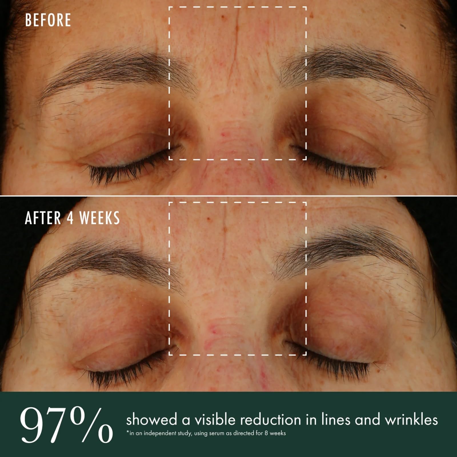 RéVive Brightening Serum - Skincare with Vitamin C, Niacinamide and Bio-Renewal Peptide - Evens Skin Tone, Refines Skin Texture and Reduces Wrinkles